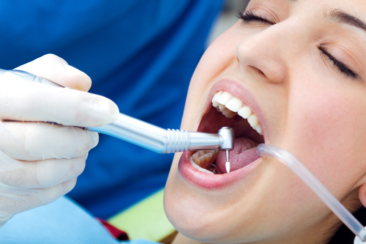 sedation dentist Irving